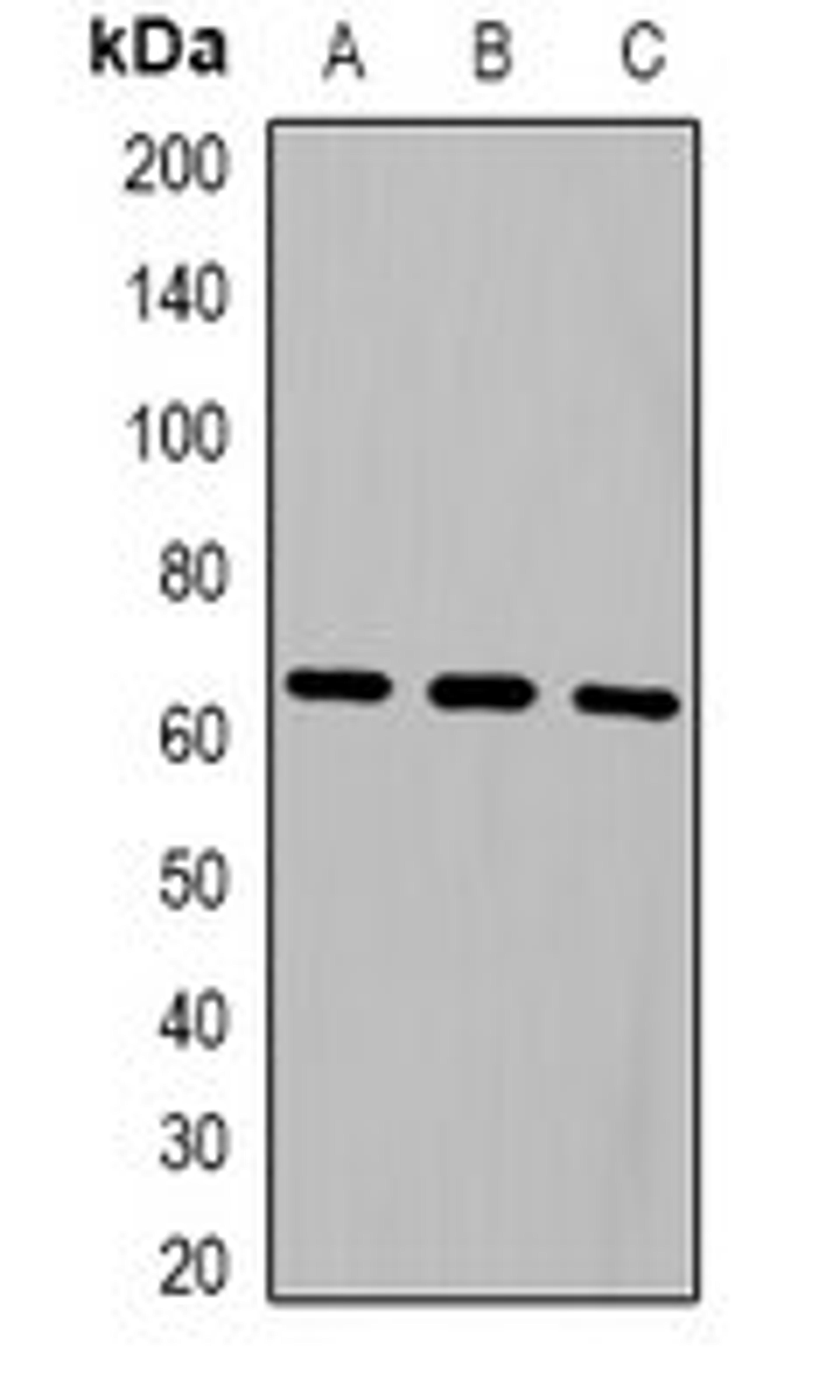 Western blot analysis of HepG2 (Lane1), Hela (Lane2), A549 (Lane3) whole cell lysates using NOP56 antibody