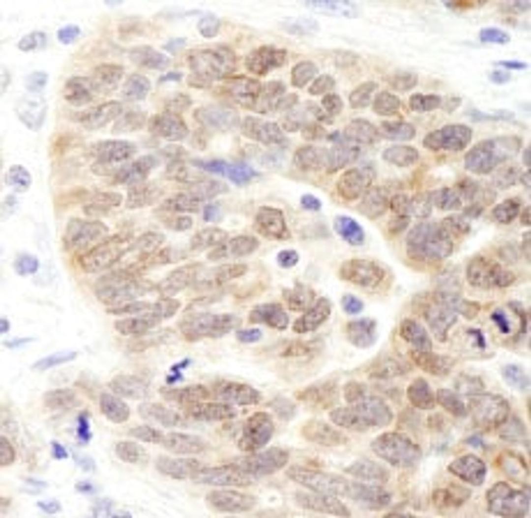 Detection of human JMJD1B by immunohistochemistry.