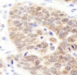 Detection of human JMJD1B by immunohistochemistry.