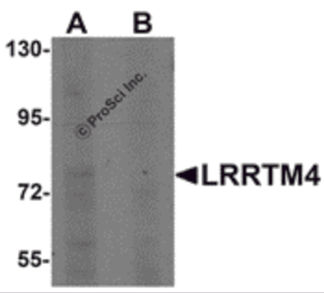 Western blot analysis of LRRTM4 in HeLa cell lysate with LRRTM4 antibody at 1 μg/mL in (A) the absence and (B) the presence of blocking peptide.