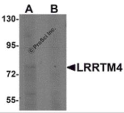 Western blot analysis of LRRTM4 in HeLa cell lysate with LRRTM4 antibody at 1 μg/mL in (A) the absence and (B) the presence of blocking peptide.