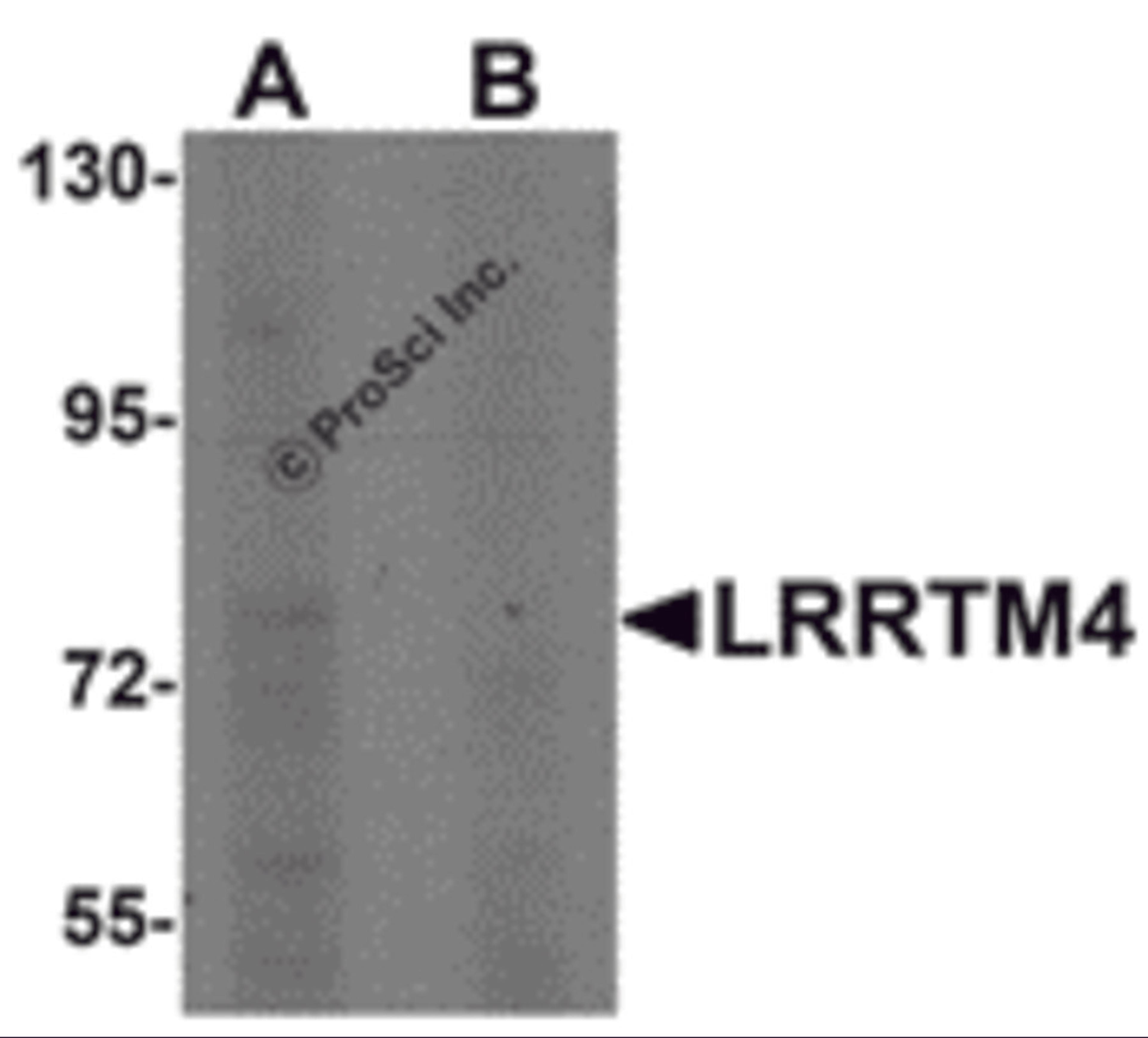 Western blot analysis of LRRTM4 in HeLa cell lysate with LRRTM4 antibody at 1 μg/mL in (A) the absence and (B) the presence of blocking peptide.