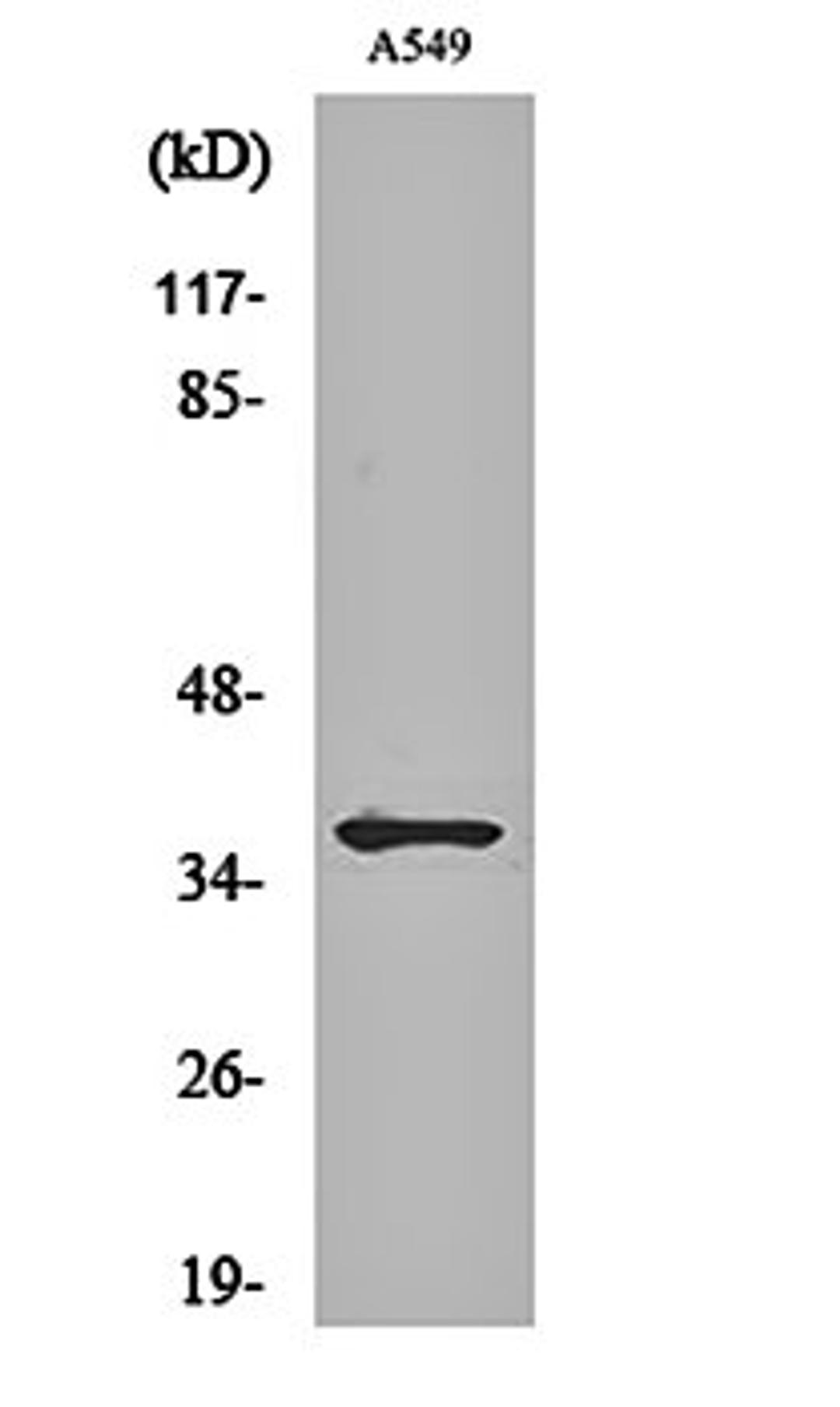 Western blot analysis of A549 cell lysates using ND1 antibody