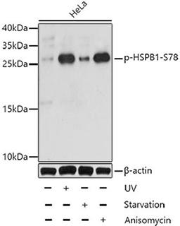 Western blot - Phospho-HSPB1-S78 antibody (AP0236)