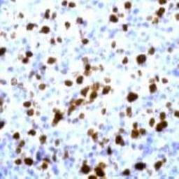 Immunohistochemistry: Ki-67/MKI67 Antibody [NB600-1209] - Man lymph node stained with anti-Ki-67 antibody, NB 600-1209