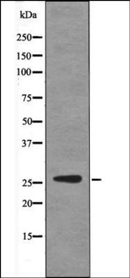 Western blot analysis of EGF treated HepG2 whole cell lysates using p27 Kip1 -Phospho-Ser178- antibody