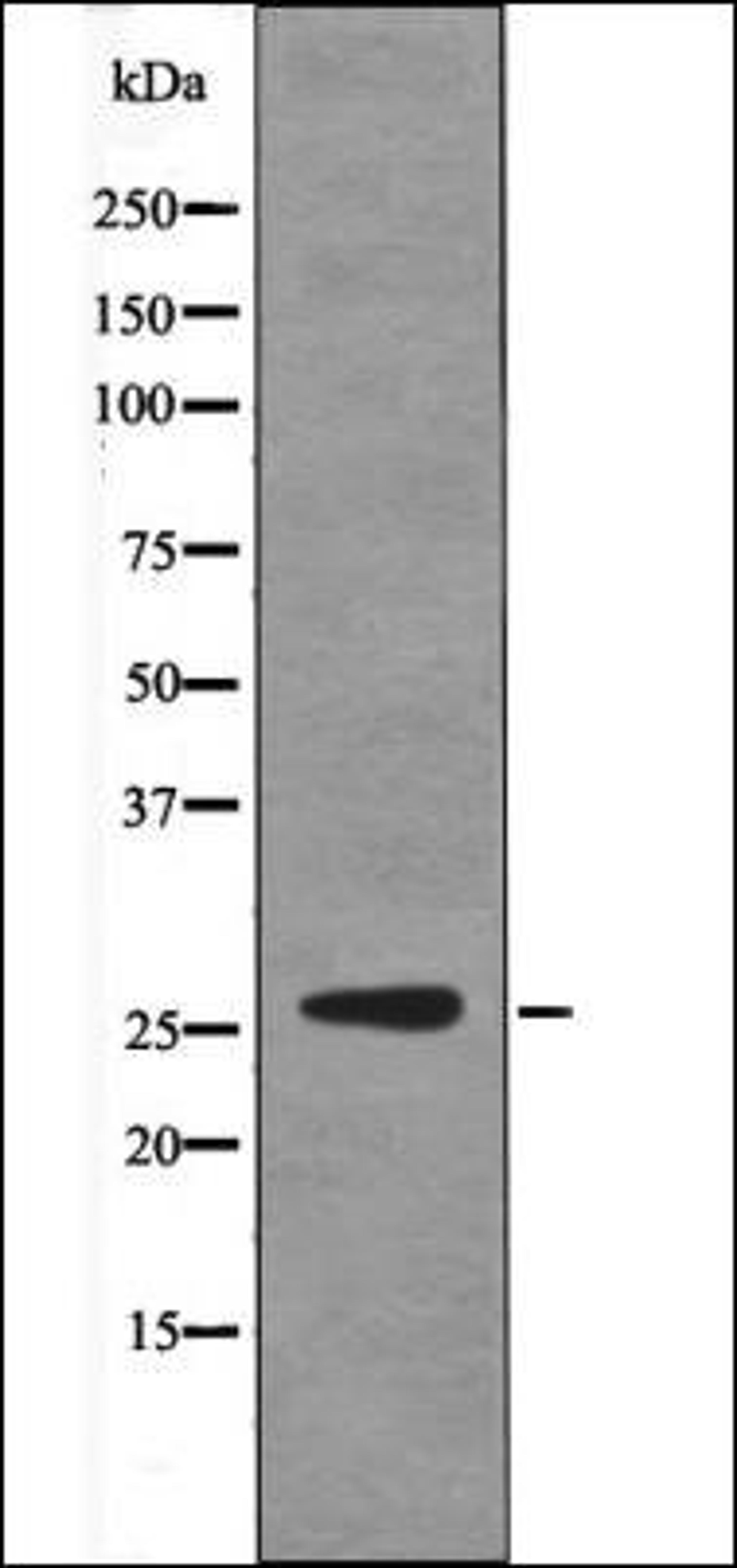 Western blot analysis of EGF treated HepG2 whole cell lysates using p27 Kip1 -Phospho-Ser178- antibody