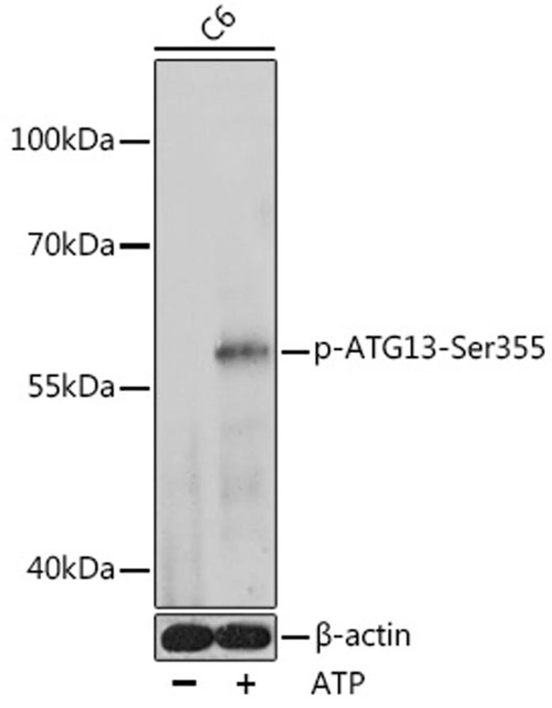 Western blot - Phospho-ATG13-Ser355 antibody (AP1089)