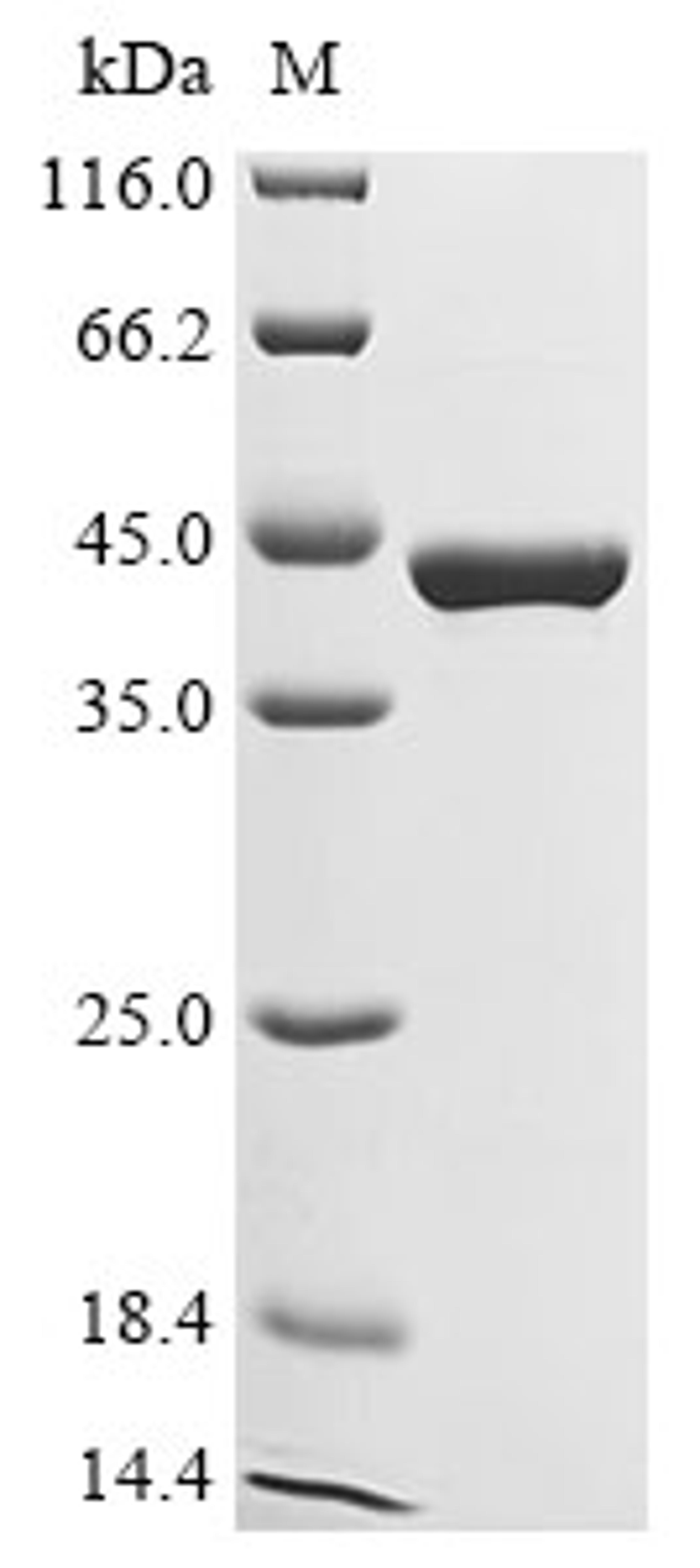 (Tris-Glycine gel) Discontinuous SDS-PAGE (reduced) with 5% enrichment gel and 15% separation gel.