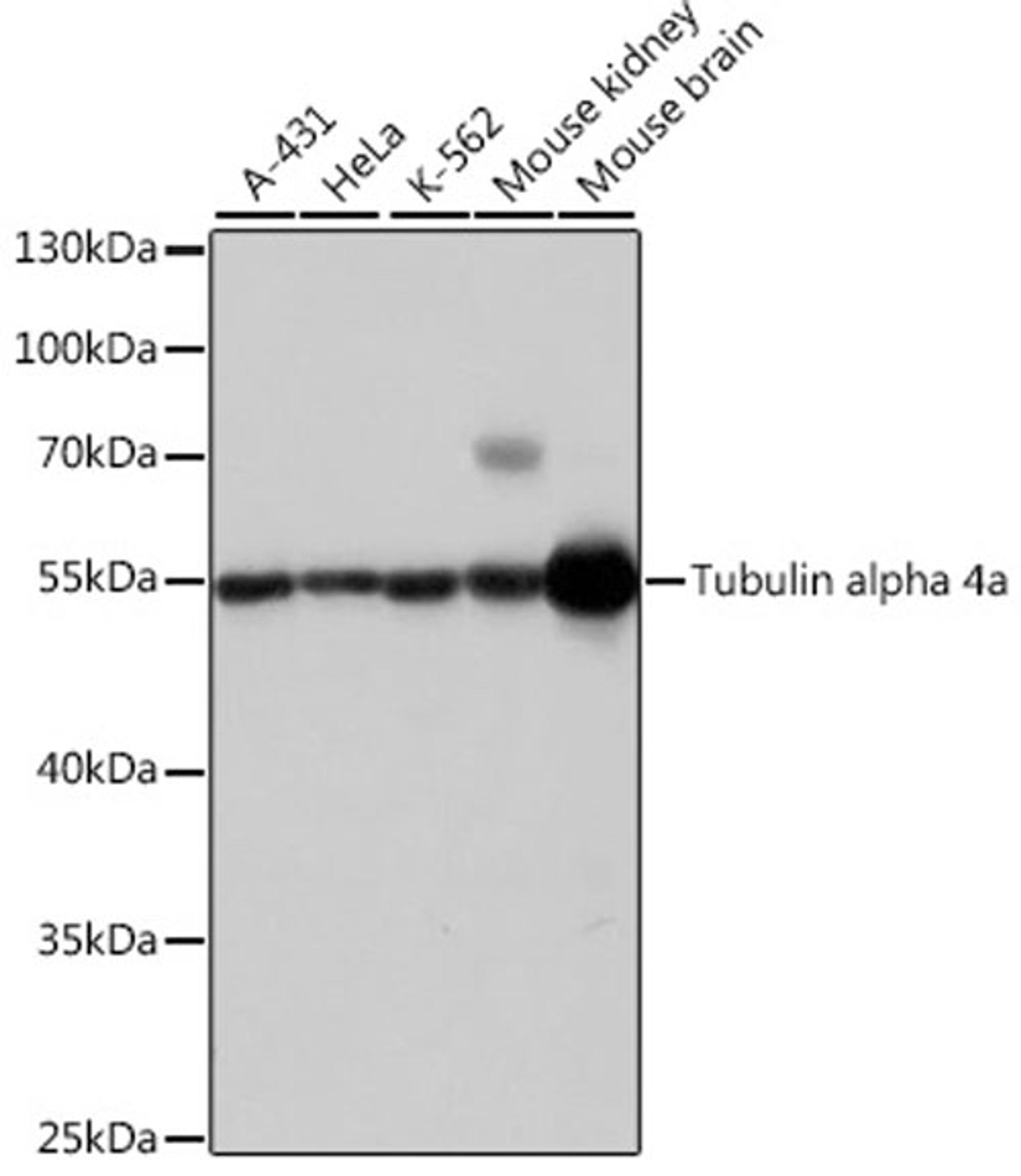 Western blot - Tubulin alpha 4a antibody (AC007)