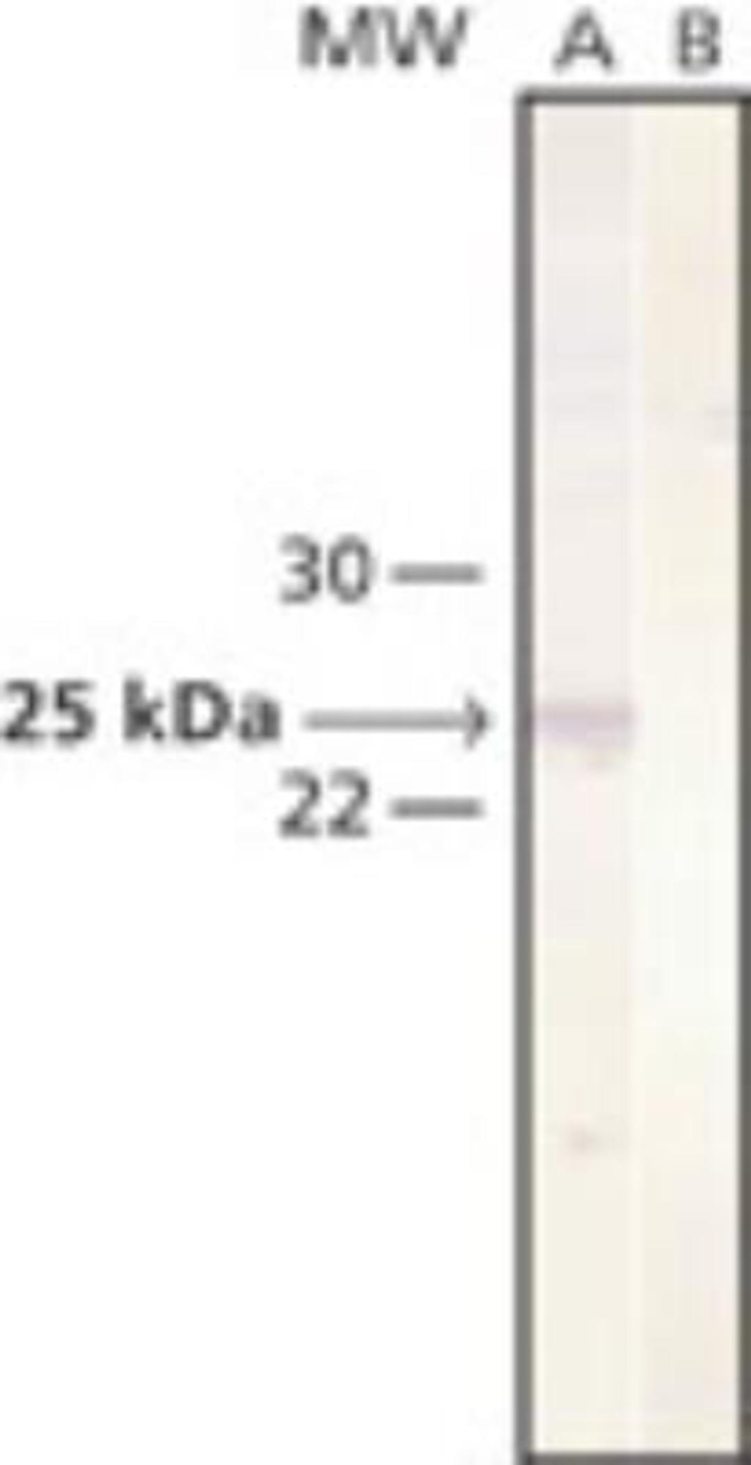 Western Blot: Cathepsin L Antibody (33/2) [NB100-1775] - Whole cell extract of Mv 1 Lu cultured mink lung was separated on SDS-PAGE and blotted with Monoclonal Anti-Cathepsin L. The antibody was developed with Goat Anti-Mouse IgG (Fab), AlkPhos Conjugate and NBT/BCIP substrate. Lane A: Antibody dilution 1:400. Lane B: Negative control (only secondary antibody).