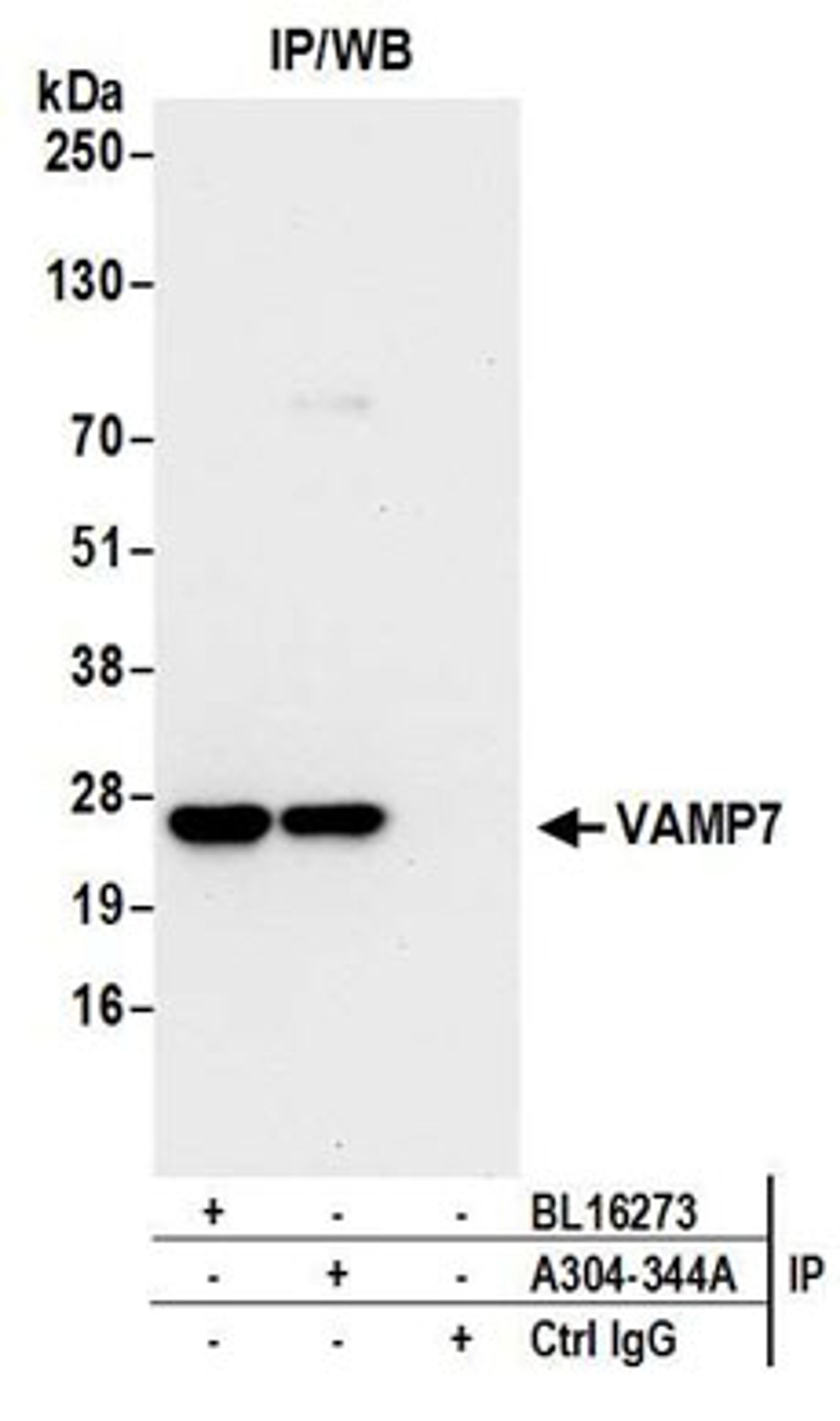 Detection of human VAMP7 by western blot of immunoprecipitates.