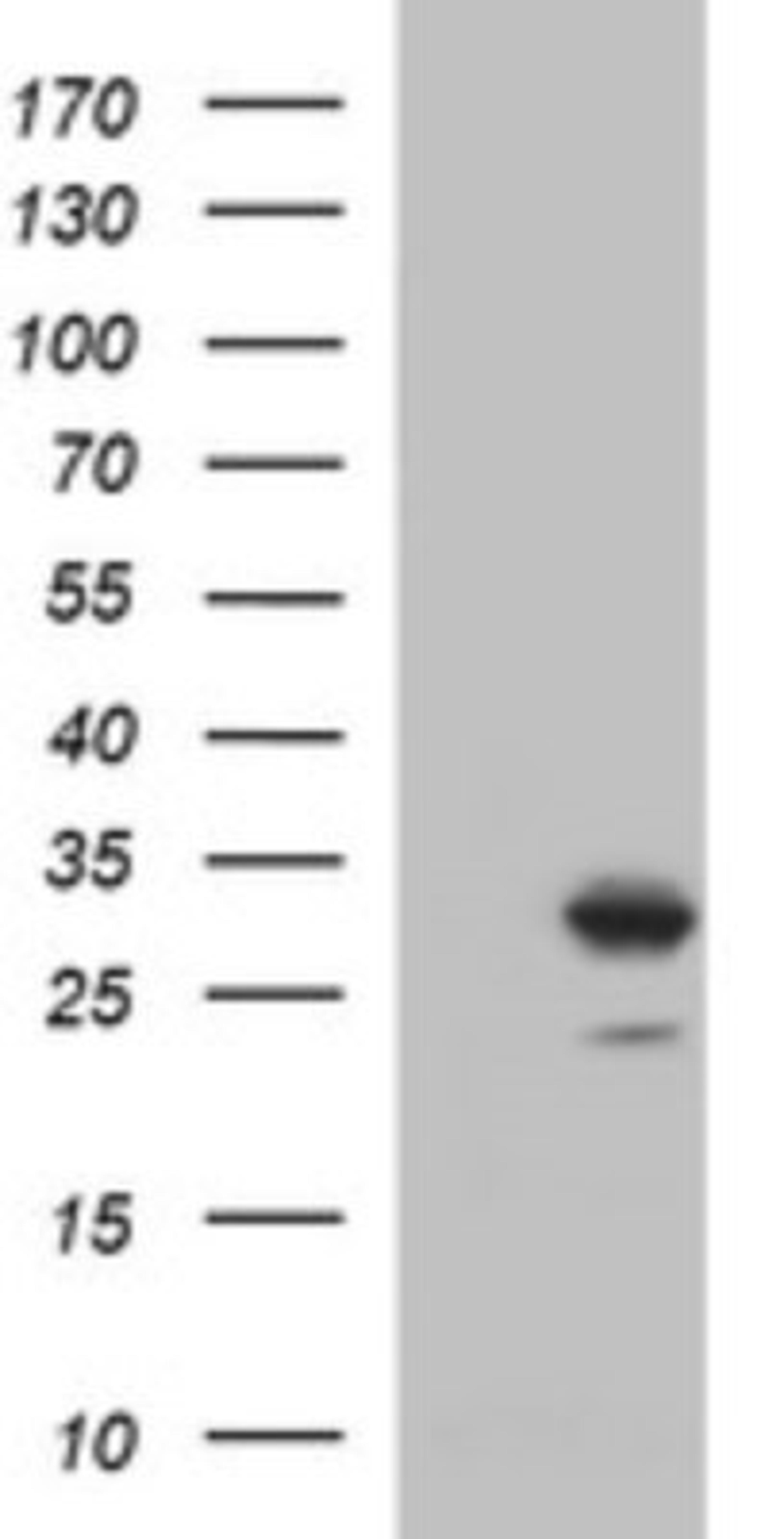 Western Blot: Placental Lactogen/CSH1 Antibody (2G4) [NBP2-46376] - Analysis of HEK293T cells were transfected with the pCMV6-ENTRY control (Left lane) or pCMV6-ENTRY CSH1.