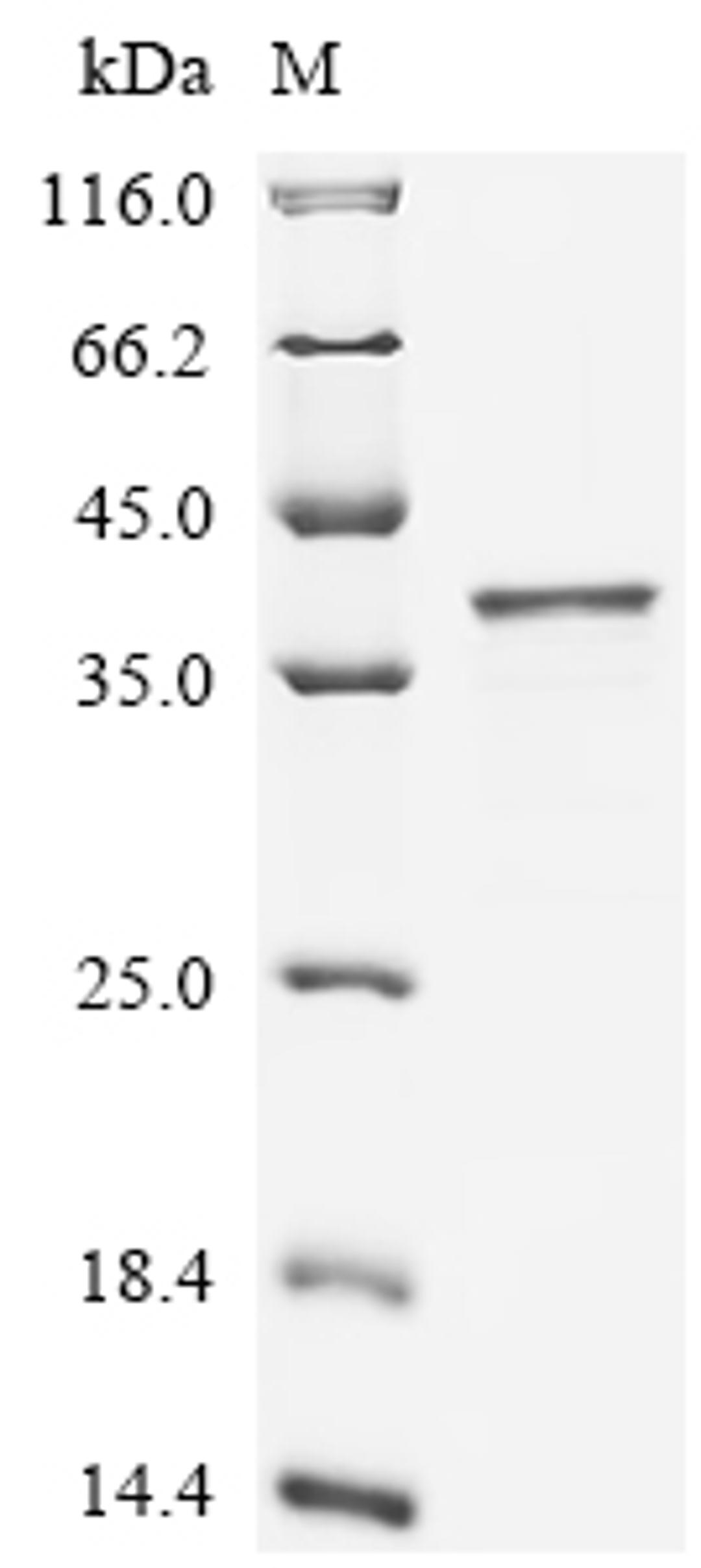 (Tris-Glycine gel) Discontinuous SDS-PAGE (reduced) with 5% enrichment gel and 15% separation gel.