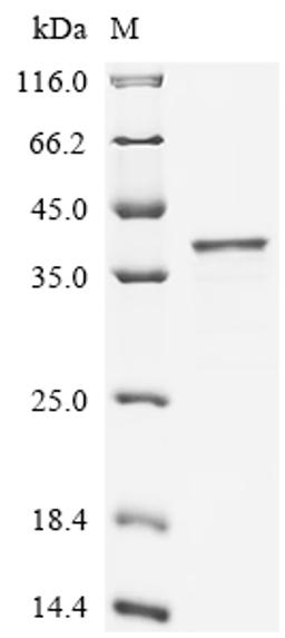 (Tris-Glycine gel) Discontinuous SDS-PAGE (reduced) with 5% enrichment gel and 15% separation gel.