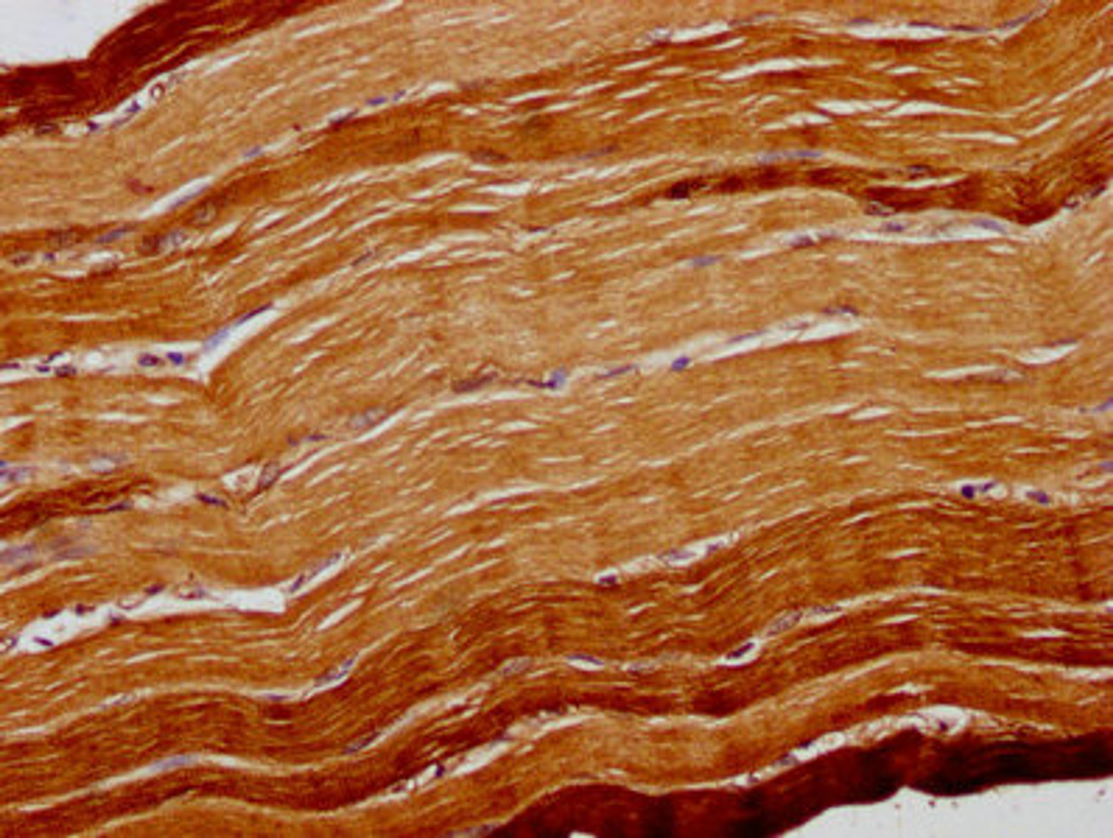 IHC image of CSB-PA002332LA01HU diluted at 1:300 and staining in paraffin-embedded human skeletal muscle tissue performed on a Leica BondTM system. After dewaxing and hydration, antigen retrieval was mediated by high pressure in a citrate buffer (pH 6.0). Section was blocked with 10% normal goat serum 30min at RT. Then primary antibody (1% BSA) was incubated at 4&deg;C overnight. The primary is detected by a biotinylated secondary antibody and visualized using an HRP conjugated SP system.