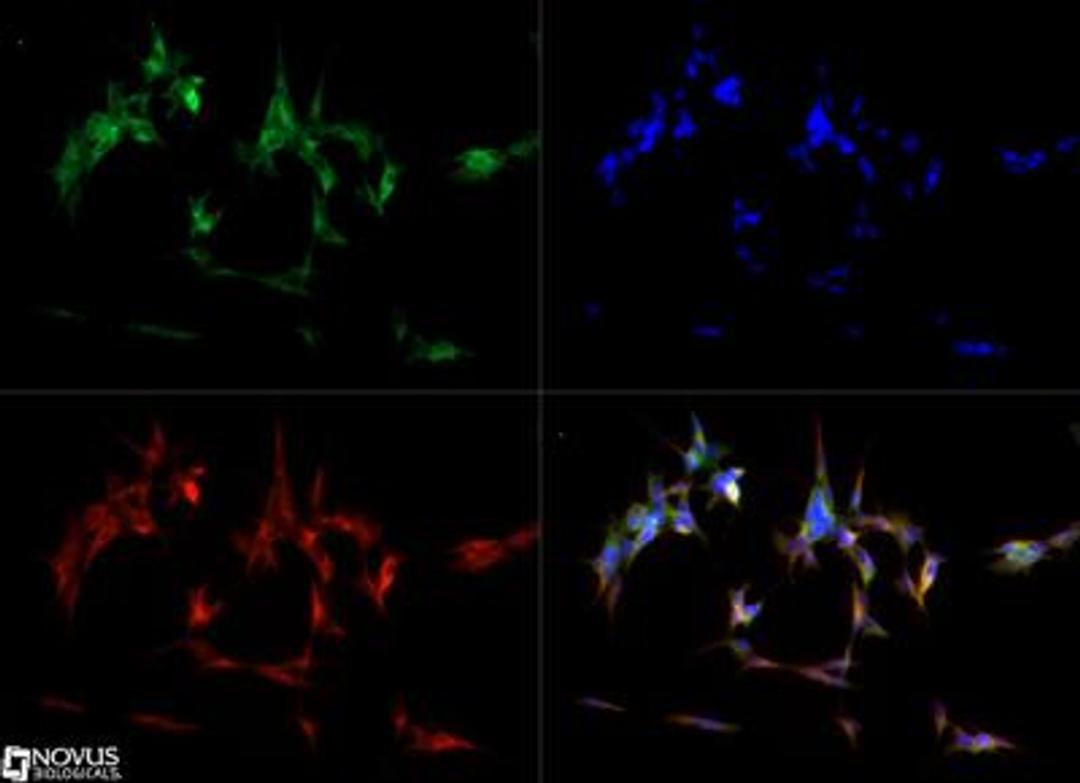 Immunocytochemistry/Immunofluorescence: Abeta 40 Antibody [NB300-225] - The Abeta 40 antibody was tested in SH-SY5Y cells at a 1:1000 dilution against Dylight 488 (Green). Alpha tubulin and nuclei were counterstained against Dylight 550 (Red) and DAPI (Blue), respectively.