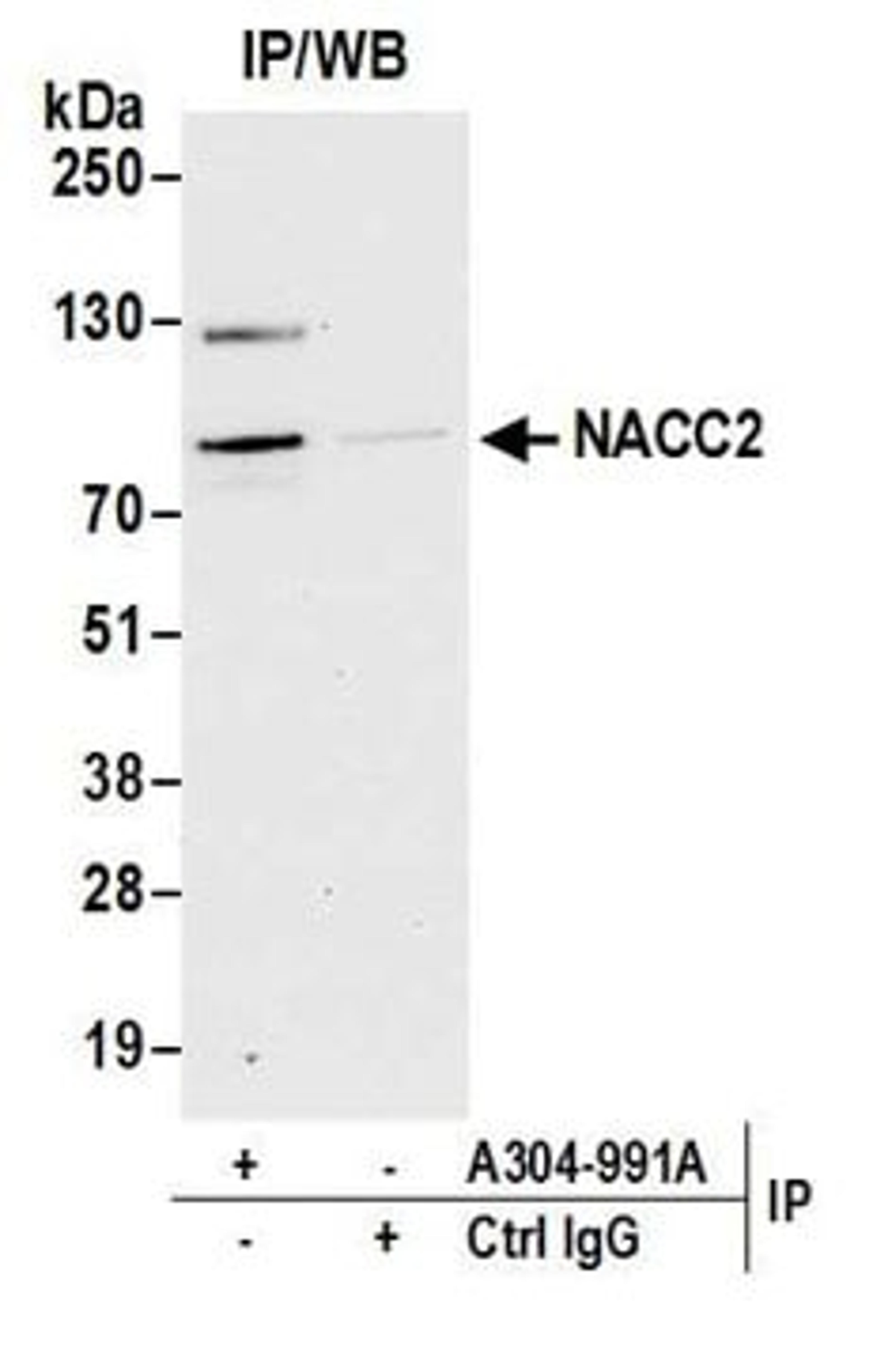 Detection of human NACC2 by western blot of immunoprecipitates.