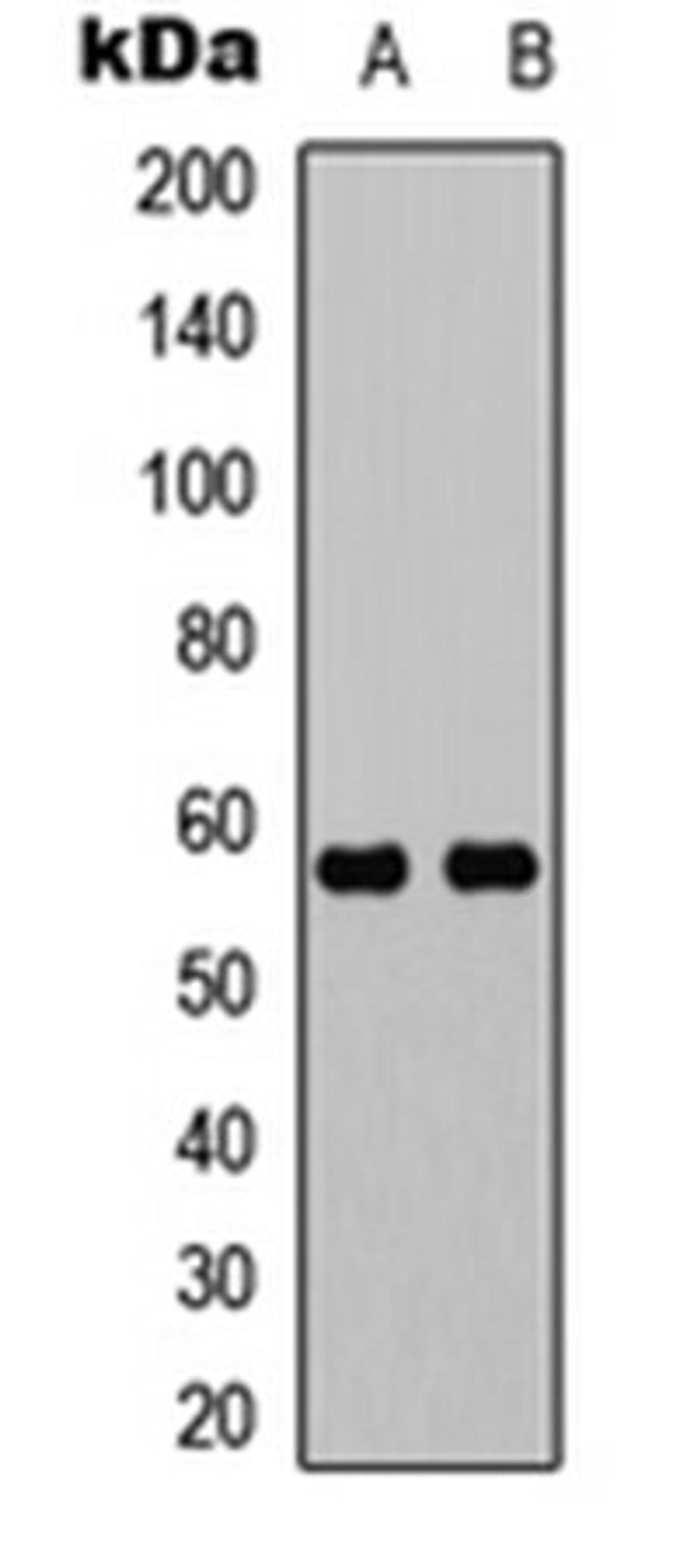 Western blot analysis of K562 (Lane 1), mouse brain (Lane 2) whole cell lysates using UBXN11 antibody