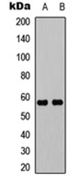 Western blot analysis of K562 (Lane 1), mouse brain (Lane 2) whole cell lysates using UBXN11 antibody