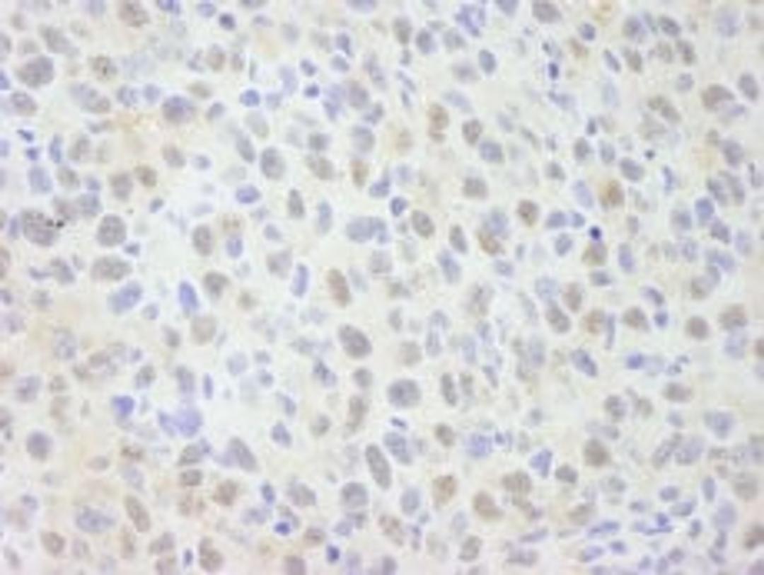 Detection of mouse NCOA62 by immunohistochemistry.