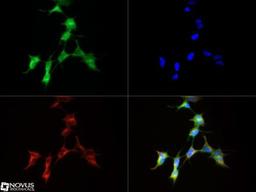 Immunocytochemistry/Immunofluorescence: IGSF4A/SynCAM1/CADM1 Antibody [NB300-186] - SynCAM/CADM1 antibody was tested in SH-SY-5Y cells with Dylight 488 (green). Nuclei and alpha-tubulin were counterstained with DAPI (blue) and Dylight 550 (red).