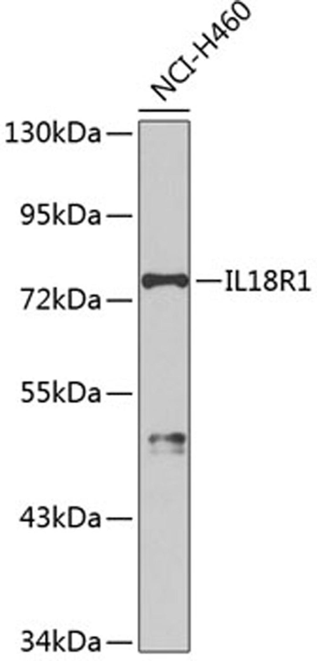 Western blot - IL18R1 antibody (A2706)