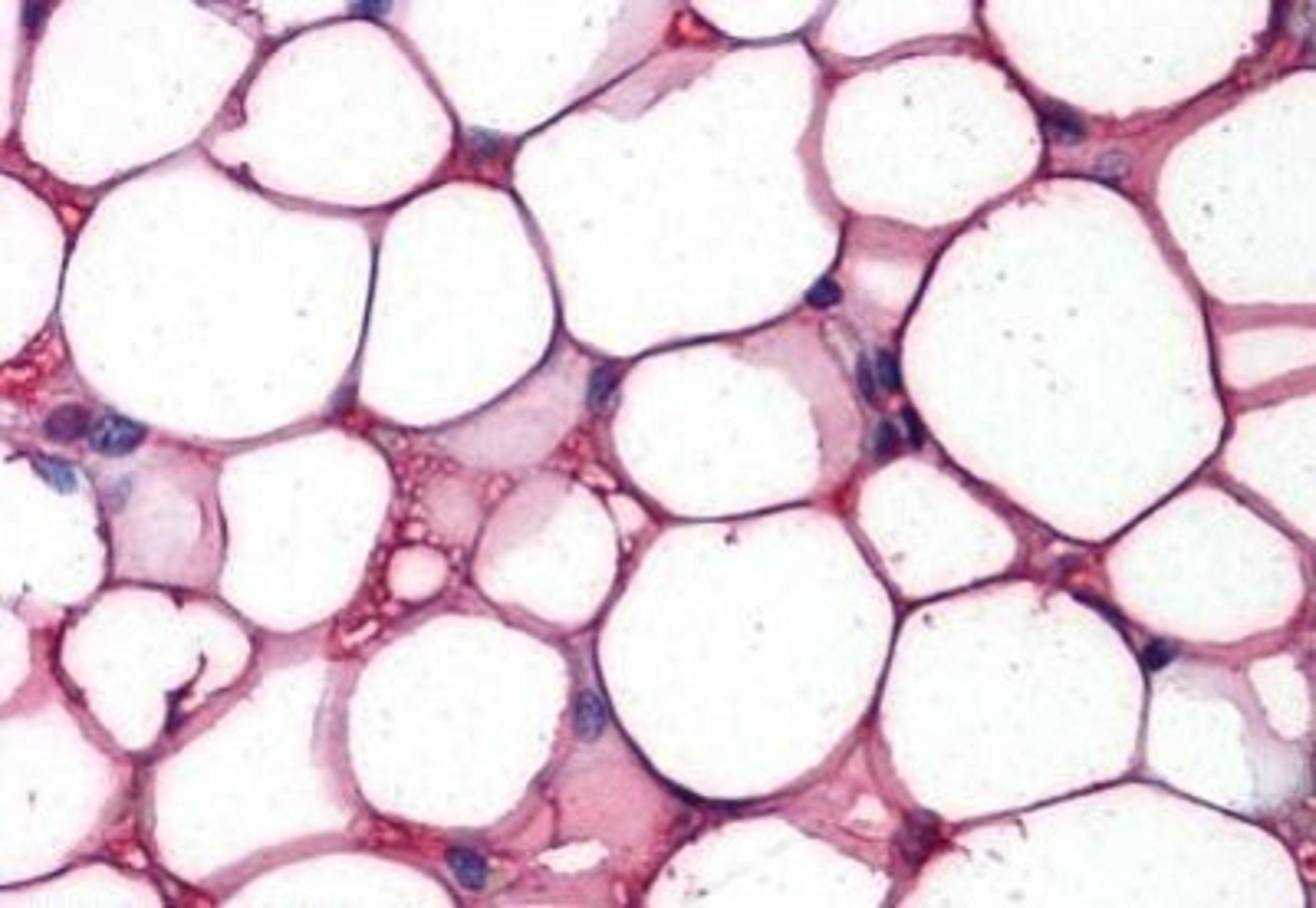 Immunohistochemistry-Paraffin: FABP4/A-FABP [p Tyr20] Antibody [NBP1-52460] - Analysis of anti-FABP4 antibody with human adipocytes at concentration 5 ug/ml.