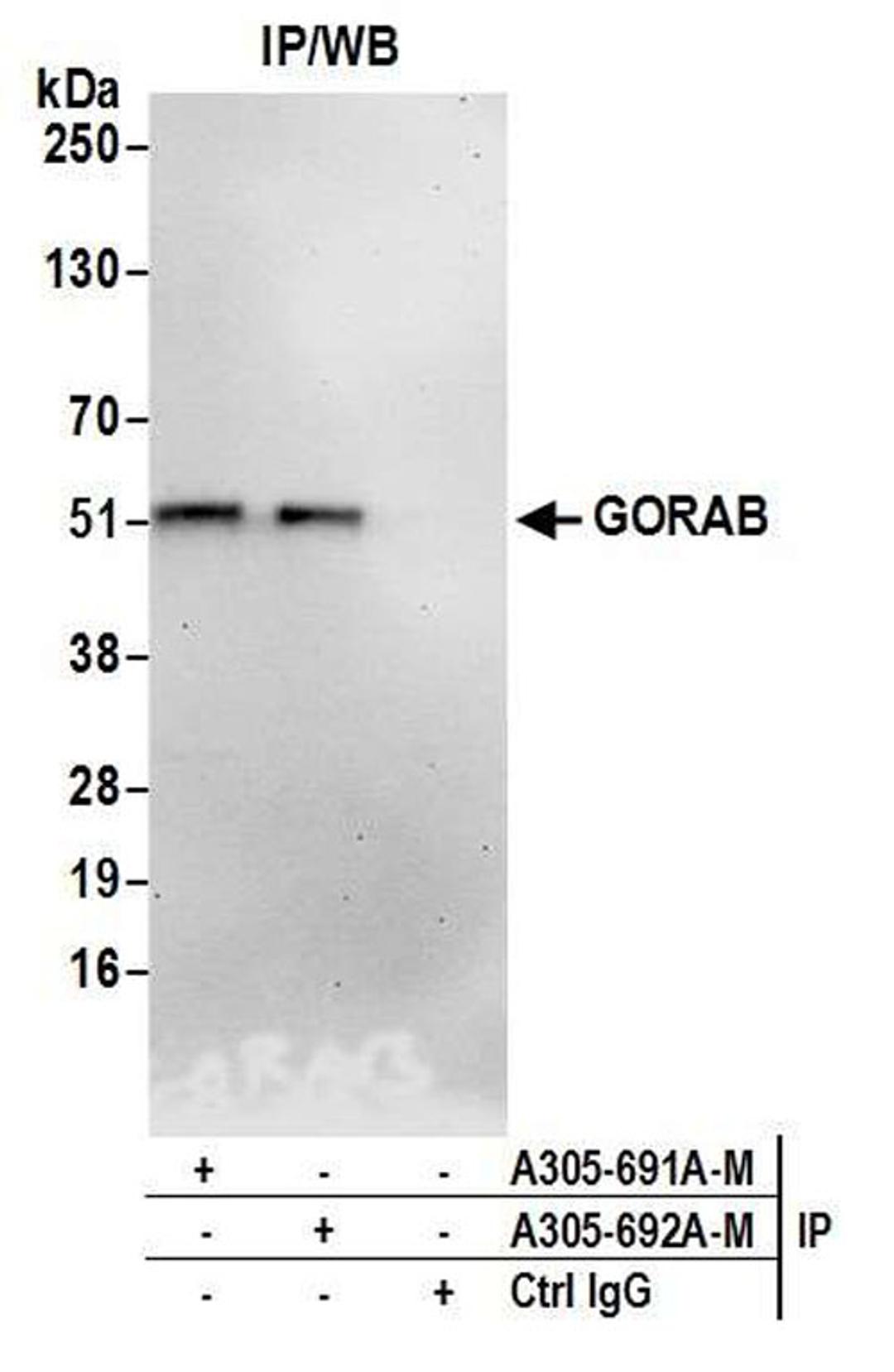 Detection of human GORAB by WB of IP.