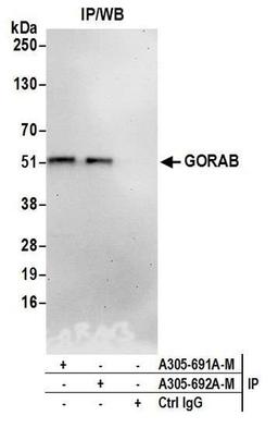 Detection of human GORAB by WB of IP.