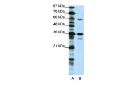 Antibody used in WB on Human HepG2 at 1.25 ug/ml.