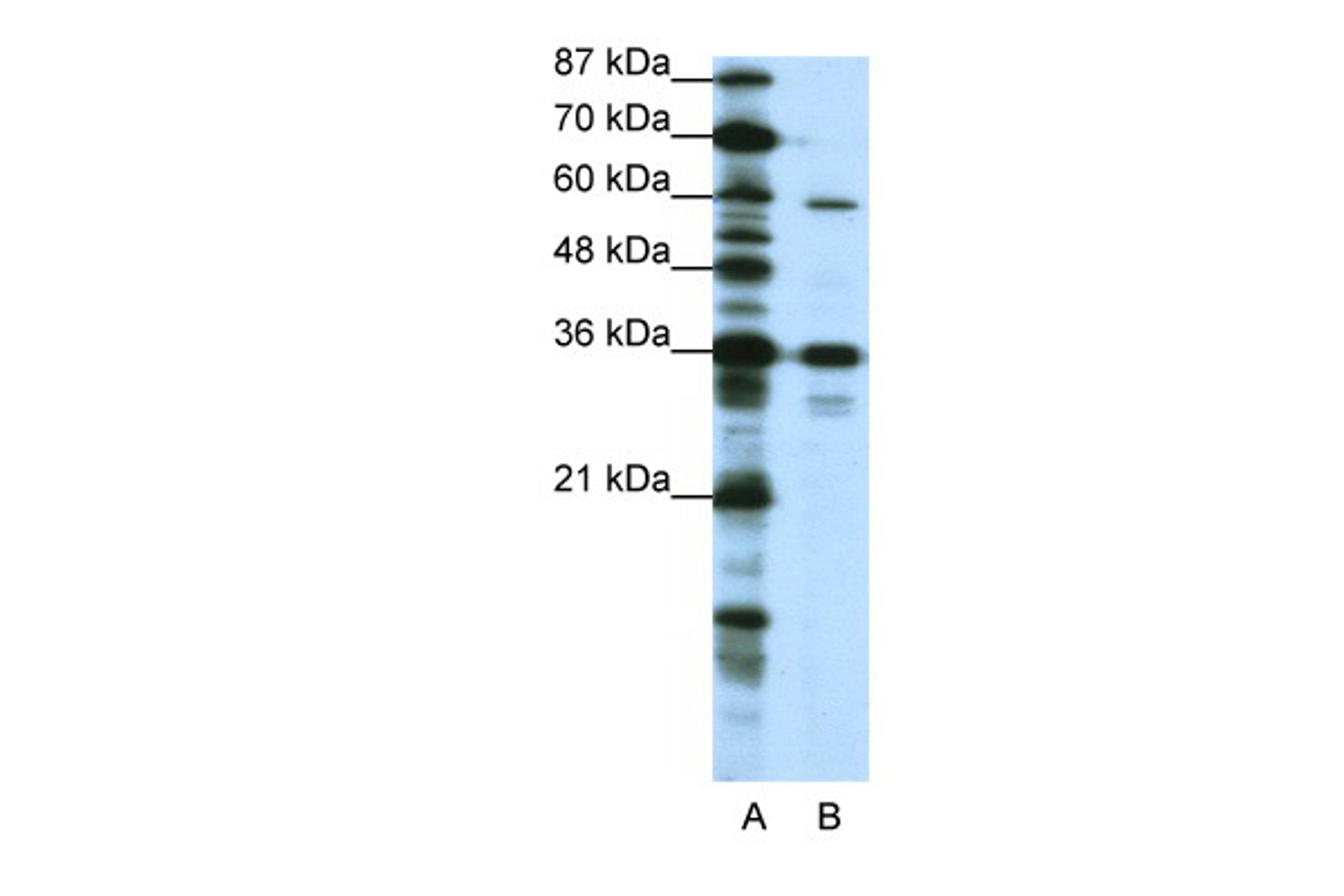 Antibody used in WB on Human HepG2 at 1.25 ug/ml.