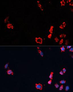 Immunofluorescence - Caspase-10 Polyclonal Antibody (A0169)