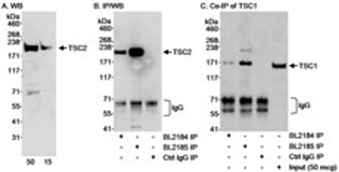 Detection of human TSC2 by western blot and immunoprecipitation and Co-IP of TSC1 with TSC2.