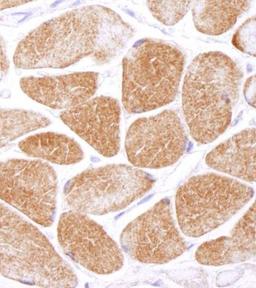 Immunohistochemistry-Paraffin: AMPK alpha 1 Antibody [NB100-239] - Human muscle;  Antibody used at a dilution of 1:5,000 (0.2ug/ml).