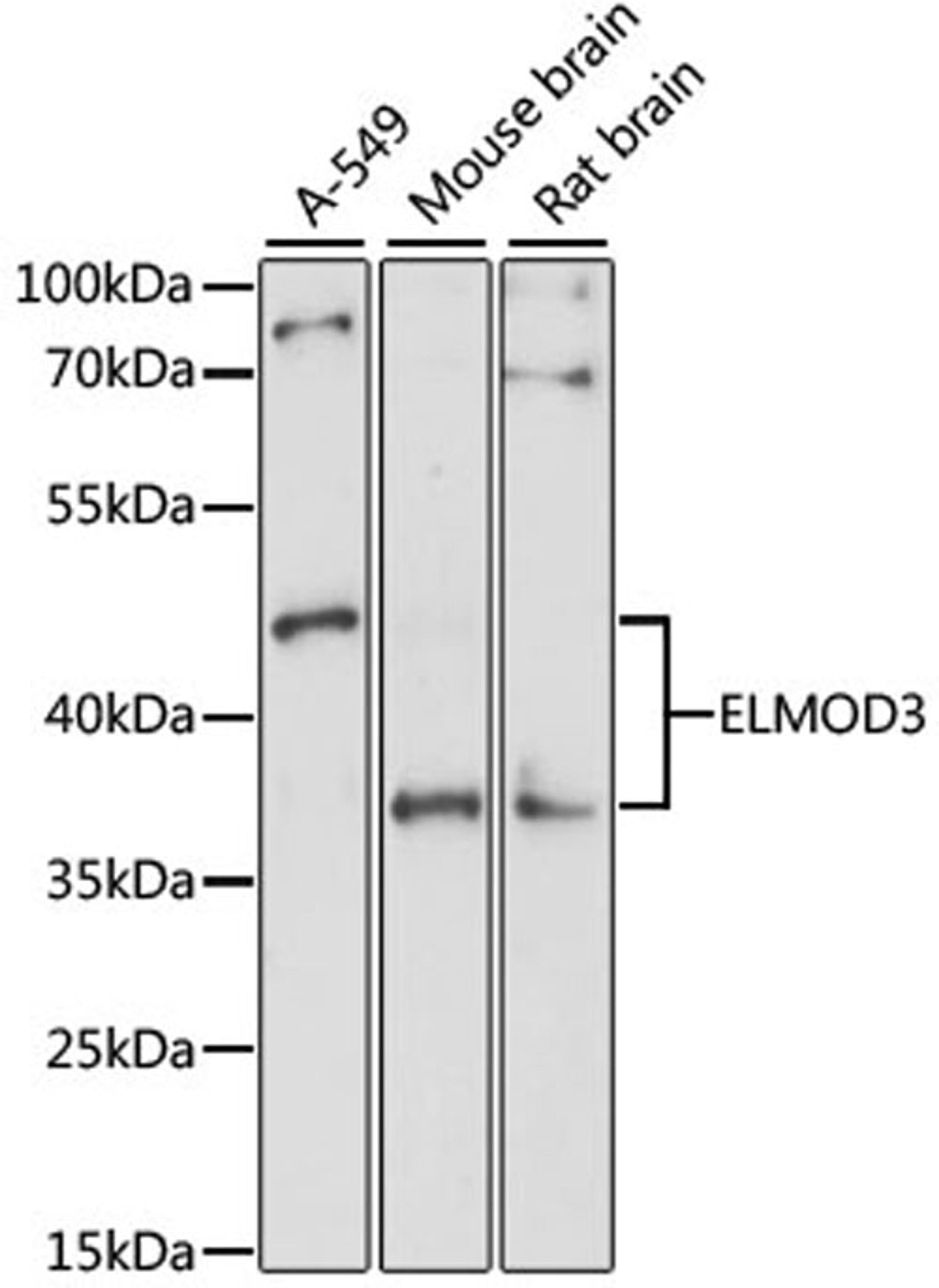 Western blot - ELMOD3 antibody (A7532)