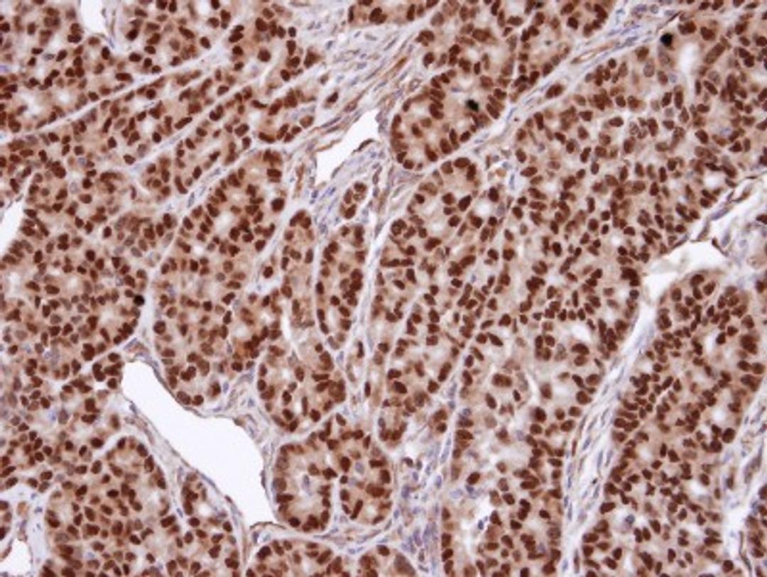 Immunohistochemistry-Paraffin: SNURPORTIN1 Antibody [NBP1-31101] - Paraffin-embedded AGS xenograft, using antibody at 1:100 dilution.