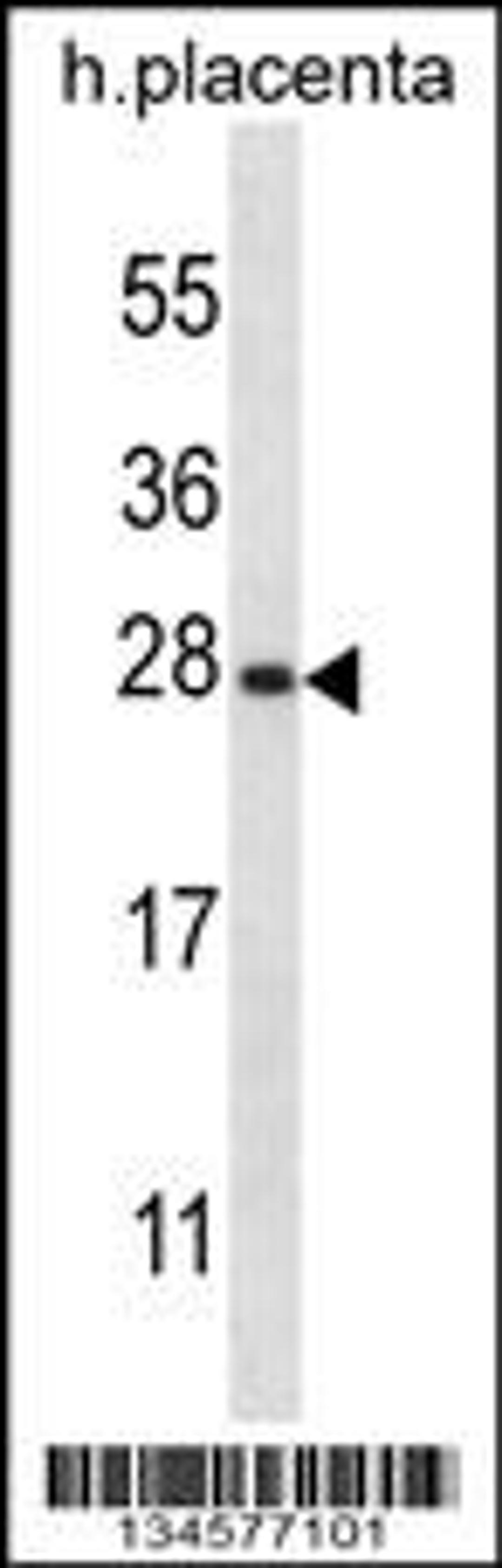 Western blot analysis in human placenta tissue lysates (35ug/lane).