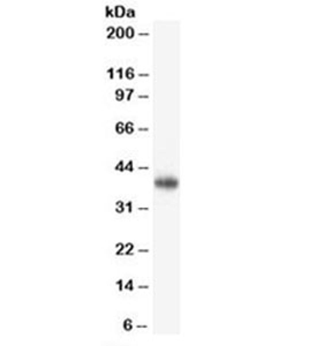 Western blot testing of human brain lysate with CD47 antibody (clone B6H12.2). Predicted molecular weight ~35kDa but observed at 35-60kDa depending on glycosylation level.