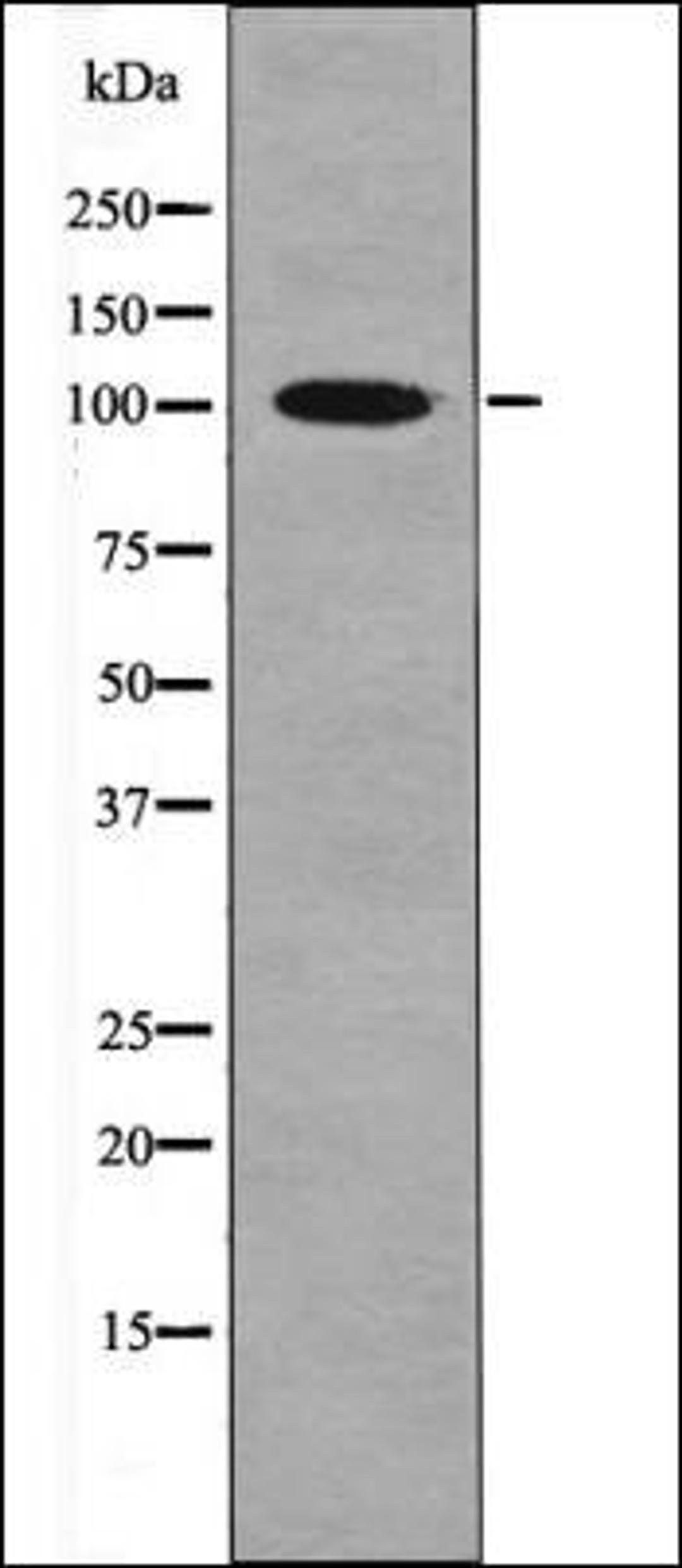 Western blot analysis of H2O2 treated 293 whole cell lysates using CTIP -Phospho-Ser327- antibody