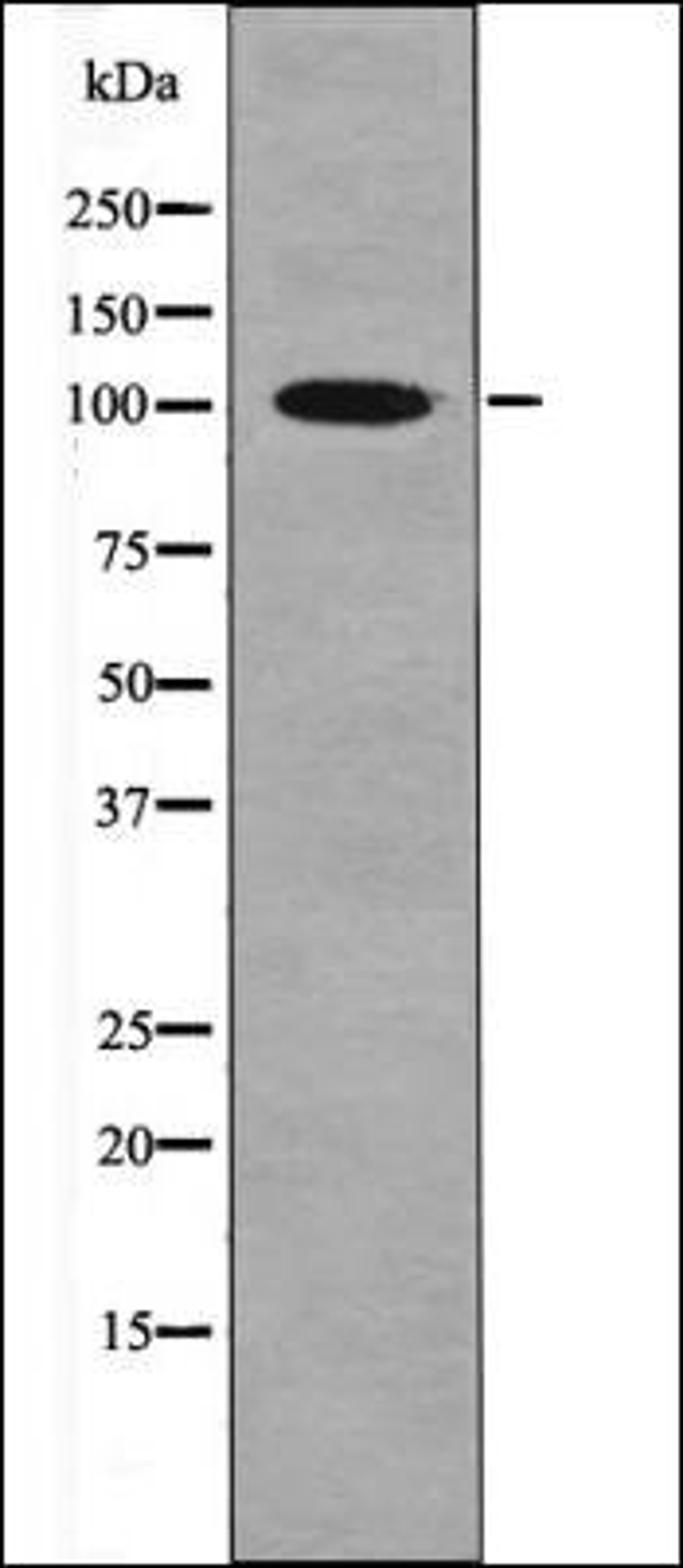 Western blot analysis of H2O2 treated 293 whole cell lysates using CTIP -Phospho-Ser327- antibody