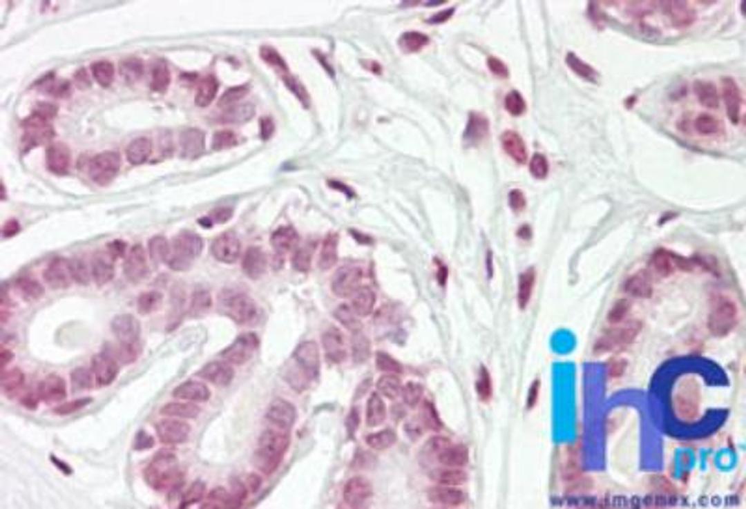 Immunohistochemistry-Paraffin: ZBTB2 Antibody [NBP2-24660] - Formalin-fixed, paraffin-embedded human breast stained with ZBTB2 antibody at 10 ug/ml.