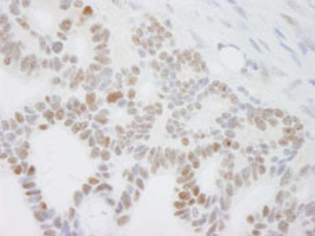 Detection of human DDX24 by immunohistochemistry.