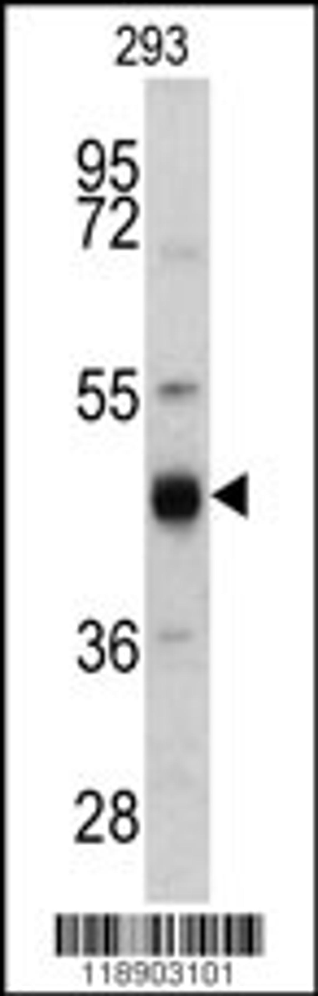 Western blot analysis of KRT13 antibody in 293 cell line lysates (35ug/lane)