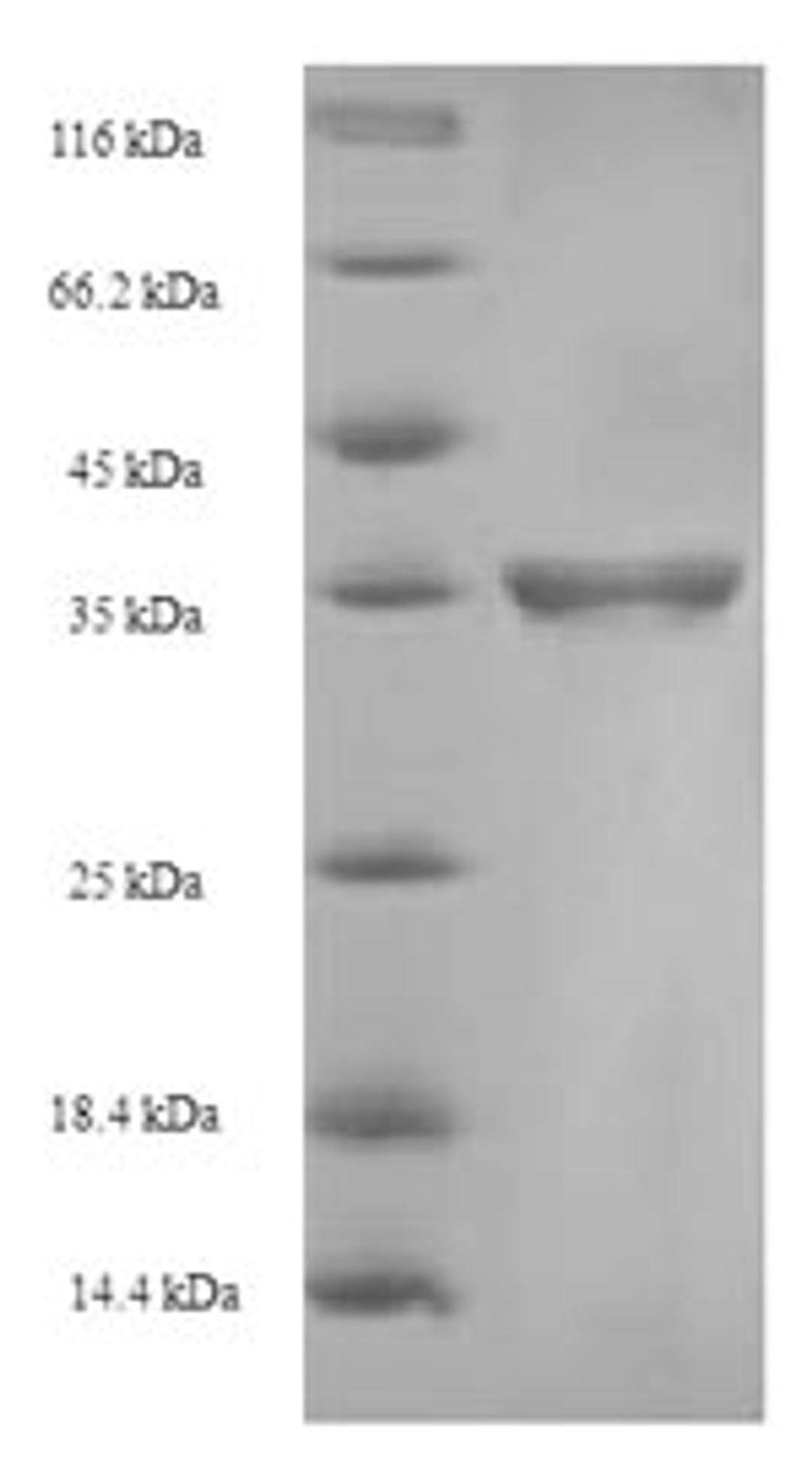 (Tris-Glycine gel) Discontinuous SDS-PAGE (reduced) with 5% enrichment gel and 15% separation gel.