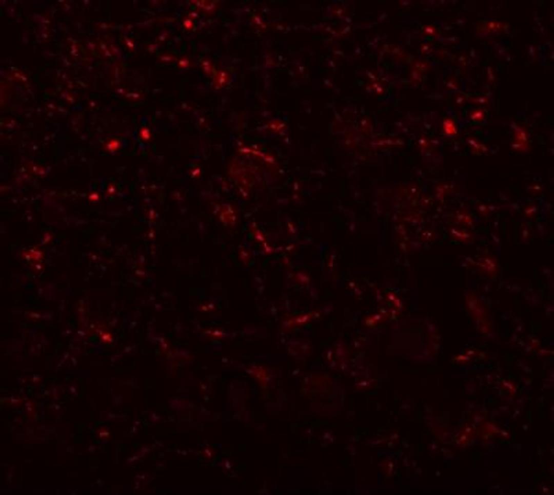 Immunocytochemistry/Immunofluorescence: AP3B2 Antibody [NBP1-76590] - Immunofluorescence of AP3B2 in mouse brain tissue with AP3B2 antibody at 20 ug/mL.