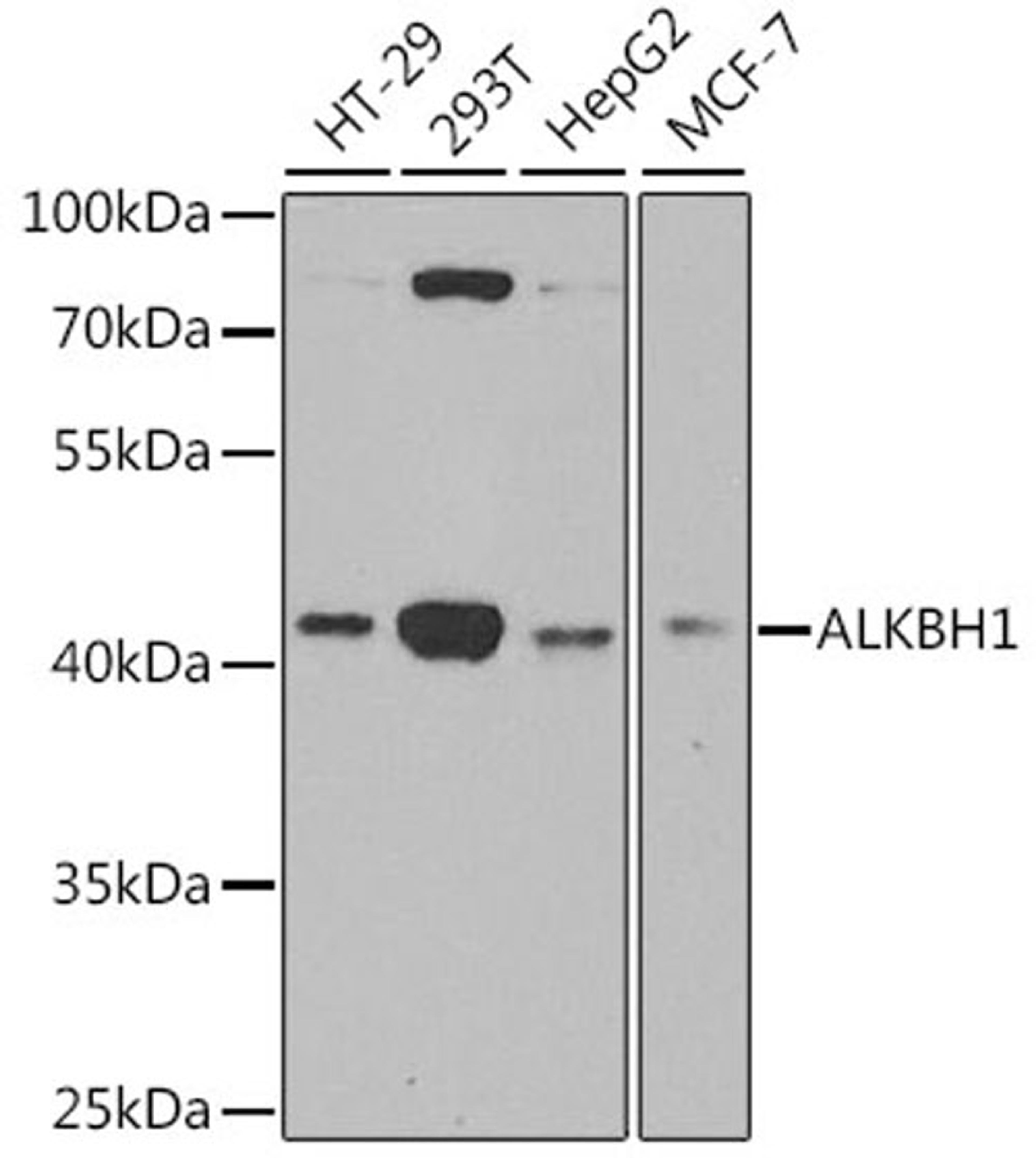 Western blot - ALKBH1 antibody (A6240)