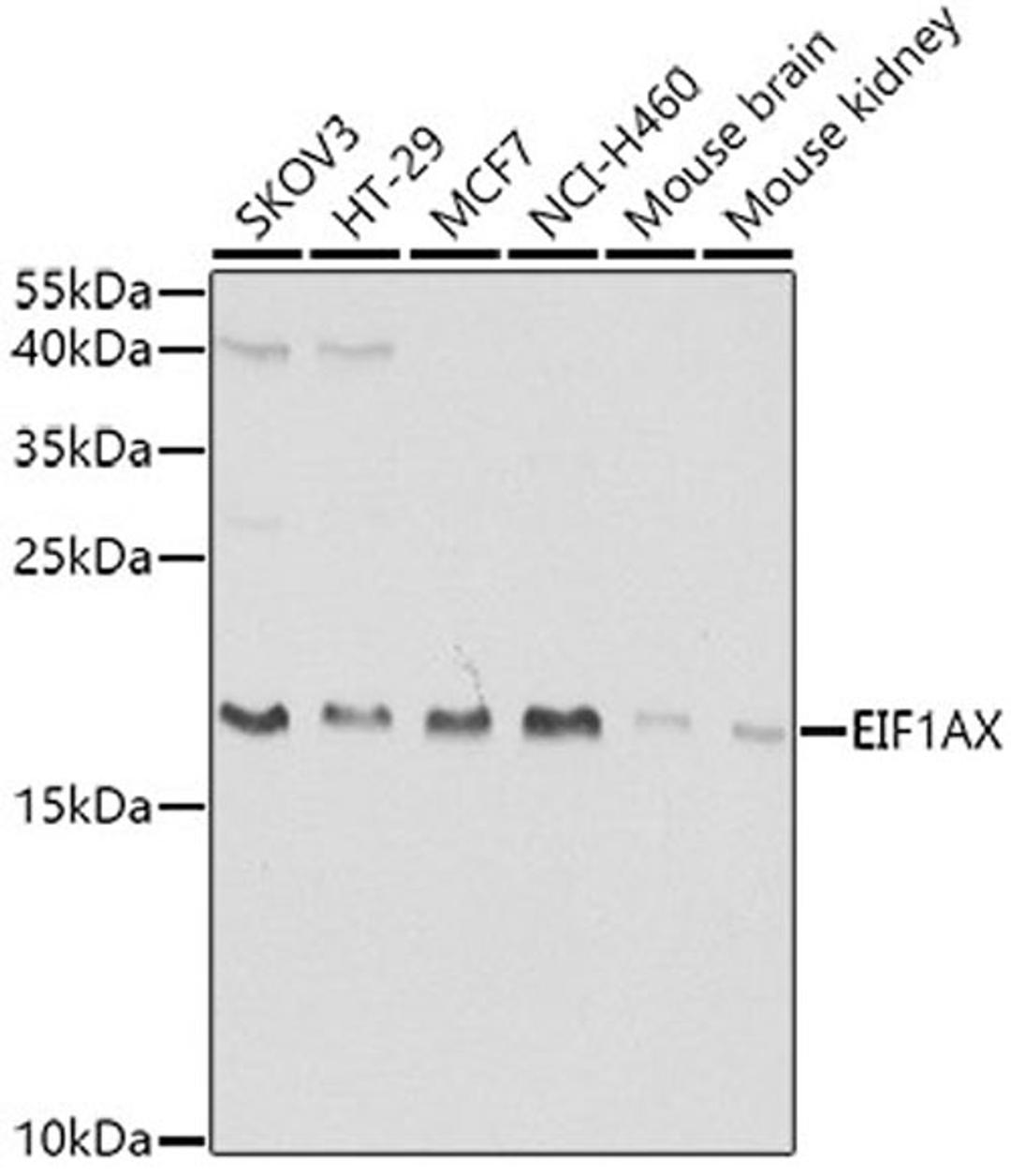 Western blot - EIF1AX antibody (A5917)