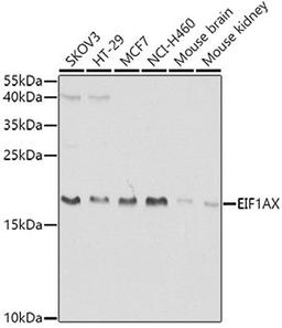 Western blot - EIF1AX antibody (A5917)