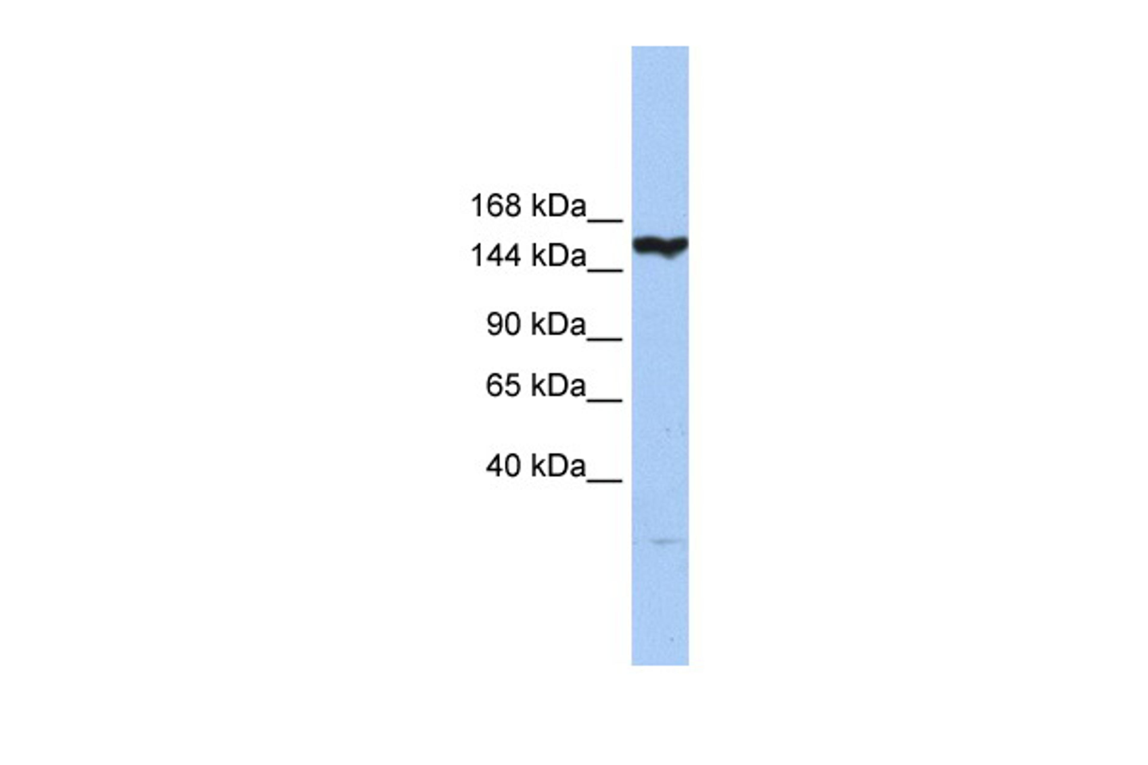 Antibody used in WB on Human HeLa at 0.2-1 ug/ml.